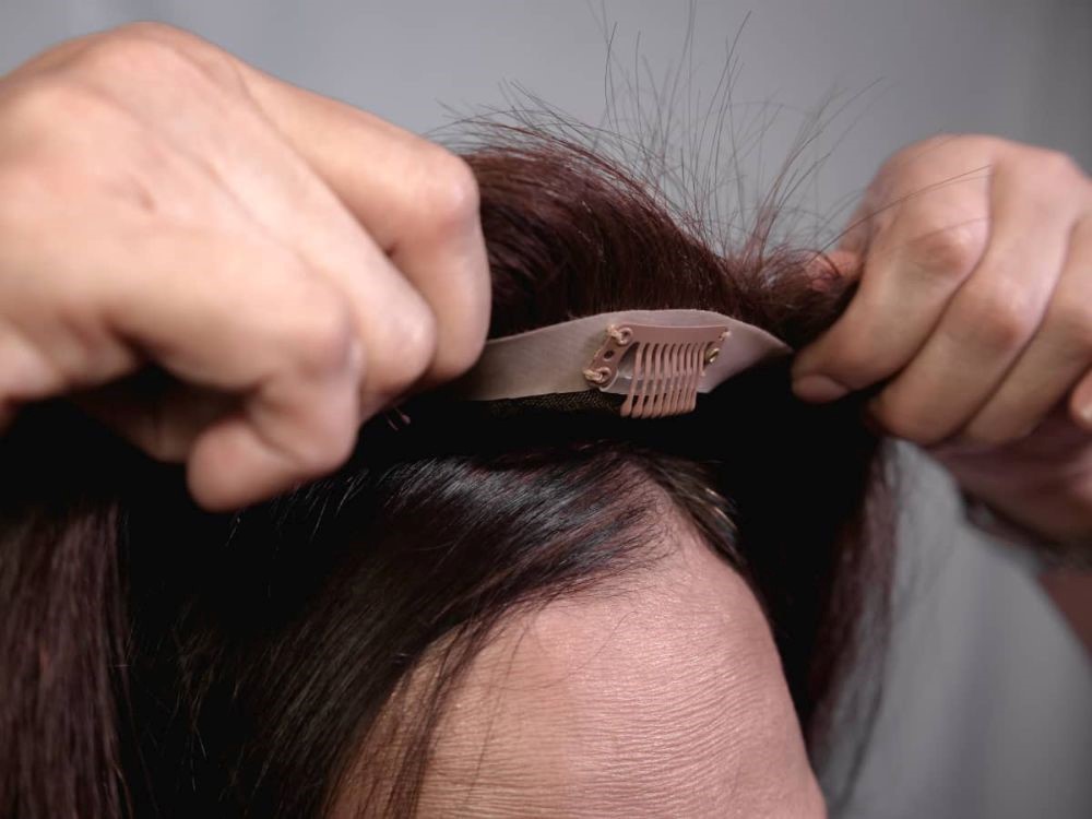 3 أنواع مقدمة شعر طبيعي تساعدك في تغطية مقدمة الرأس للذين يعانون من تساقط الشعر